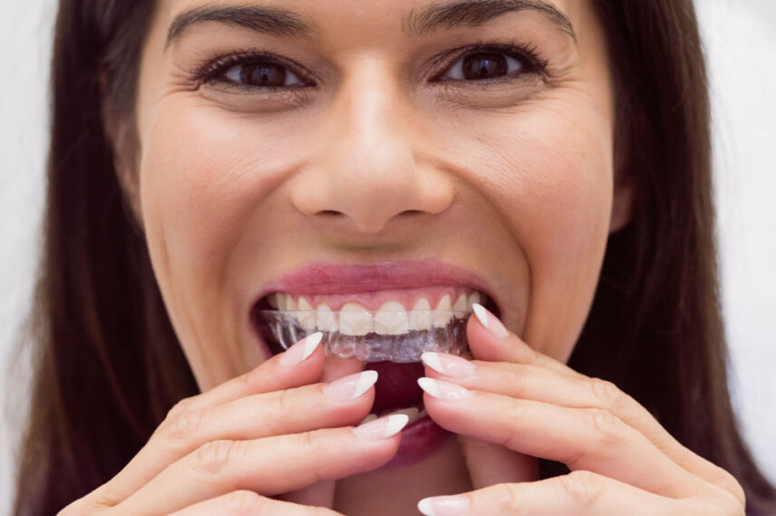 İstanbul invisalign